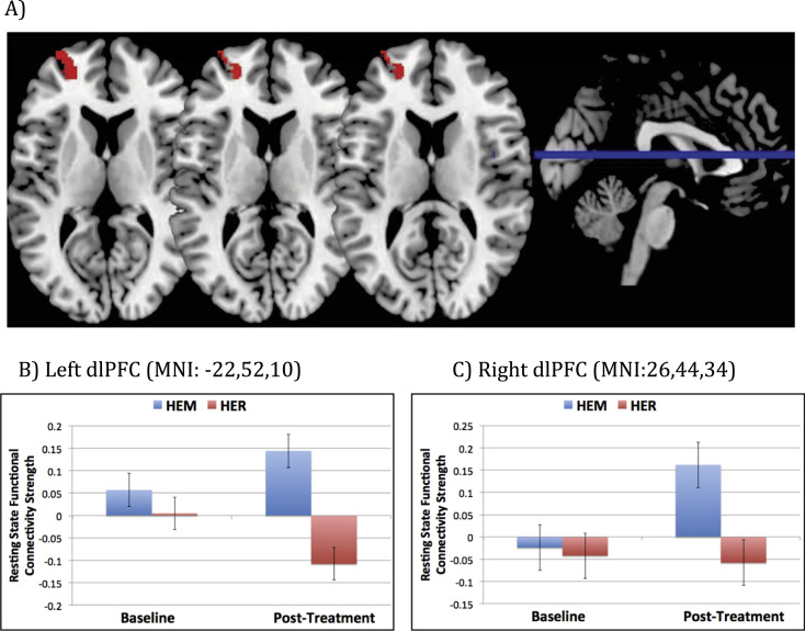 冥想對於腦部功能的改變