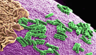 重建腸道菌叢，可使肥胖母鼠後代子嗣的社交行為及神經連結缺損回復正常