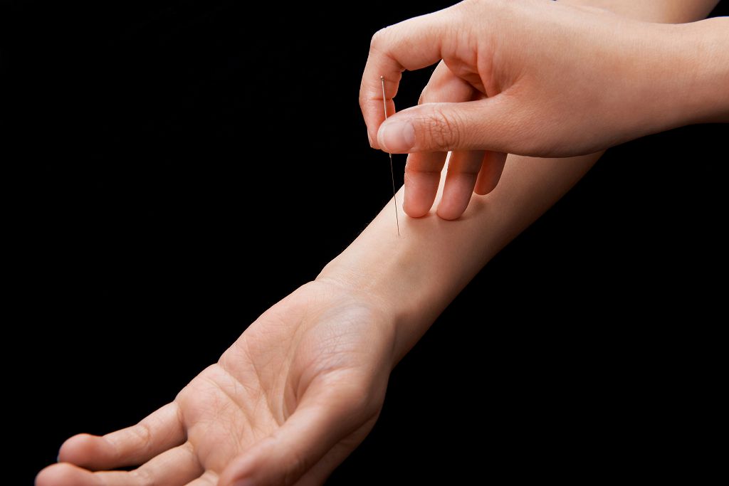 中醫針灸緩解憂鬱症狀
